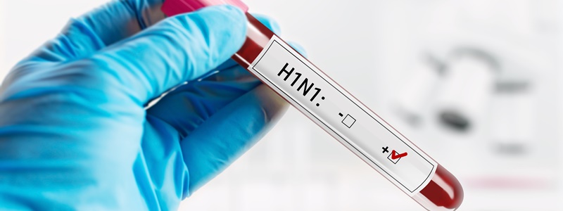 O que  H1N1?